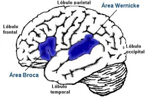 Figura Afasia de Broca (texto destino post)