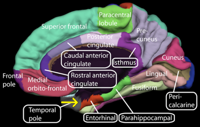 Celulas de velocidade no cortex